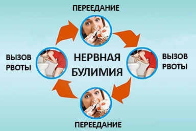 Лечение булимии в Светлом Яре